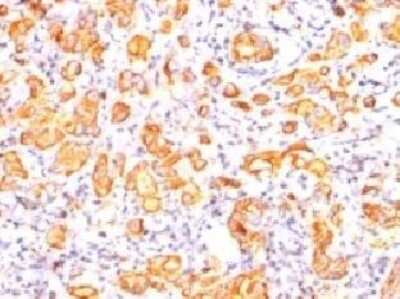 Immunohistochemistry-Paraffin: MUC1 Antibody (GP1.4) - Azide and BSA Free [NBP2-33174]