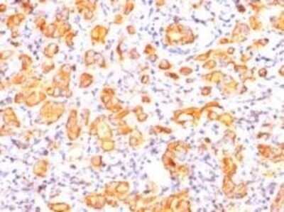 Immunohistochemistry-Paraffin: MUC1 Antibody (GP1.4) - IHC-Prediluted [NBP2-44661]