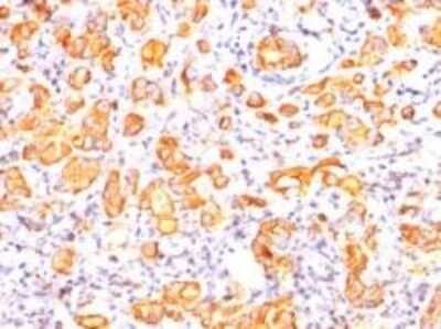 Immunohistochemistry-Paraffin: MUC1 Antibody (GP1.4) [NBP2-29408]