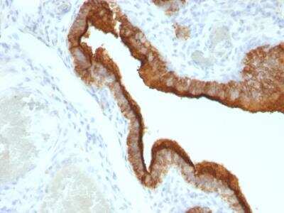 Immunohistochemistry-Paraffin: MUC1 Antibody (HMPV) - IHC-Prediluted [NBP2-48359]