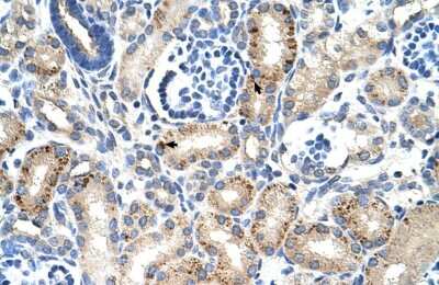 Immunohistochemistry-Paraffin: MUC1 Antibody - BSA Free [NBP1-60046]