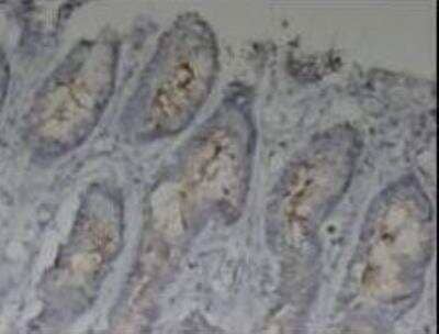 Immunohistochemistry-Paraffin: MUC1 Antibody - BSA Free [NBP1-60046]