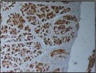 Immunohistochemistry-Paraffin: MUC1 Antibody - BSA Free [NBP1-60046]