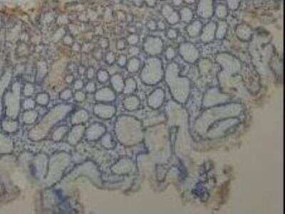 Immunohistochemistry-Paraffin: MUC1 Antibody - BSA Free [NBP1-60046]