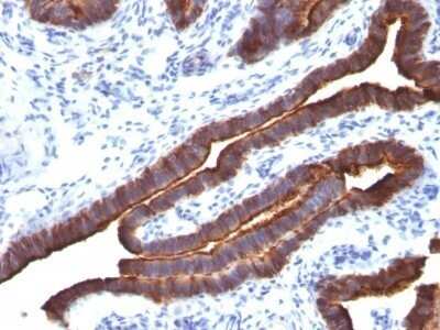 Immunohistochemistry-Paraffin: MUC1 Antibody (MUC1/520) - Azide and BSA Free [NBP2-47886]