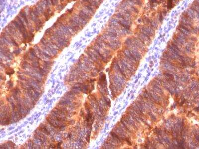 Immunohistochemistry-Paraffin: MUC1 Antibody (MUC1/520) - IHC-Prediluted [NBP2-48375]