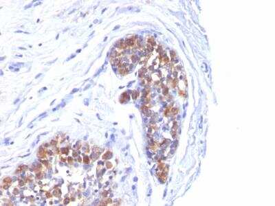 Immunohistochemistry-Paraffin: MUC1 Antibody (MUC1/520) - IHC-Prediluted [NBP2-48375]