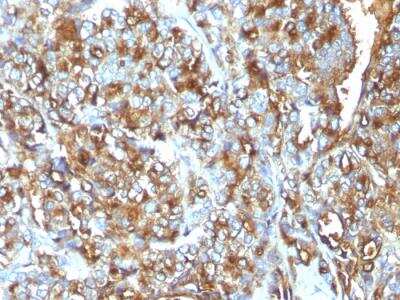 Immunohistochemistry-Paraffin: MUC1 Antibody (MUC1/520) - IHC-Prediluted [NBP2-48375]