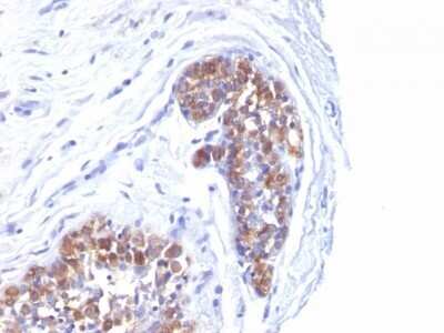 Immunohistochemistry-Paraffin: MUC1 Antibody (MUC1/520) [NBP2-44660]