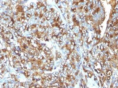 Immunohistochemistry-Paraffin: MUC1 Antibody (MUC1/520) [NBP2-44660]
