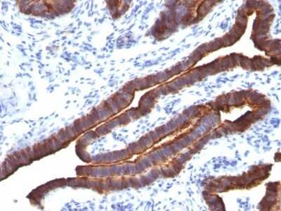 Immunohistochemistry-Paraffin: MUC1 Antibody (MUC1/520) [NBP2-44660]