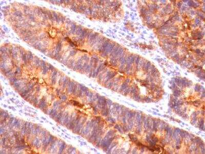 Immunohistochemistry-Paraffin: MUC1 Antibody (MUC1/845) - IHC-Prediluted [NBP2-48377]