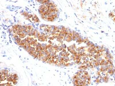 Immunohistochemistry-Paraffin: MUC1 Antibody (MUC1/845) - IHC-Prediluted [NBP2-48377]