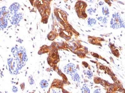 Immunohistochemistry-Paraffin: MUC1 Antibody (MUC1/845) - IHC-Prediluted [NBP2-48377]