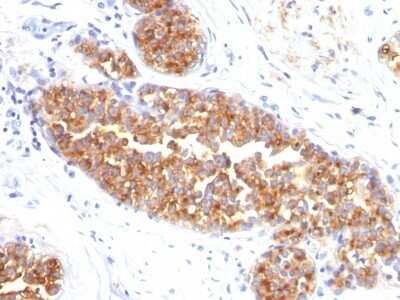 Immunohistochemistry-Paraffin: MUC1 Antibody (MUC1/845) [NBP2-44655]