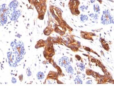 Immunohistochemistry-Paraffin: MUC1 Antibody (MUC1/845) [NBP2-44655]