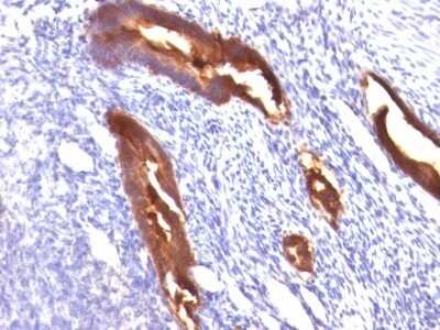 Immunohistochemistry-Paraffin: MUC1 Antibody (MUC1/845) [NBP2-44655]
