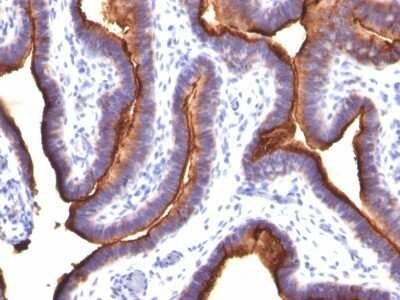 Immunohistochemistry-Paraffin: MUC1 Antibody (MUC1/845) [NBP2-44655]