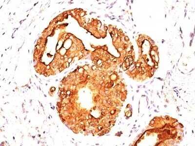Immunohistochemistry-Paraffin: MUC1 Antibody (MUC1/955) - Azide and BSA Free [NBP2-47884]