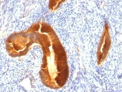 Immunohistochemistry-Paraffin: MUC1 Antibody (MUC1/955) [NBP2-44658]