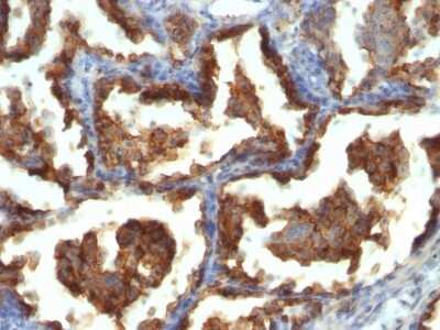 Immunohistochemistry-Paraffin: MUC1 Antibody (MUC1/955) [NBP2-44658]