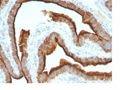 Immunohistochemistry-Paraffin: MUC1 Antibody (MUC1/967) - Azide and BSA Free [NBP2-47885]