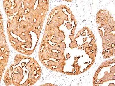 Immunohistochemistry-Paraffin: MUC1 Antibody (MUC1/967) - Azide and BSA Free [NBP2-47885]