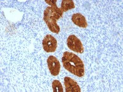 Immunohistochemistry-Paraffin: MUC1 Antibody (MUC1/967) - IHC-Prediluted [NBP2-48361]