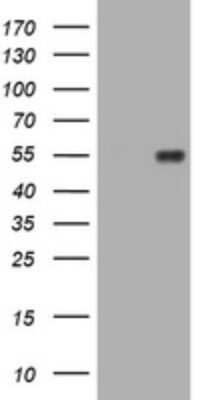 Western Blot: MUC1 Antibody (OTI2E3)Azide and BSA Free [NBP2-72826]