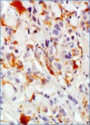 Immunohistochemistry-Paraffin: MUC1 Antibody (SM3) - Azide and BSA Free [NBP2-80859]