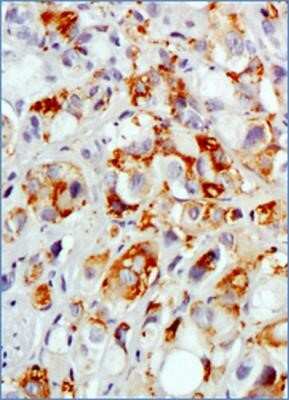 Immunohistochemistry-Paraffin: MUC1 Antibody (SM3) - Azide and BSA Free [NBP2-80859]