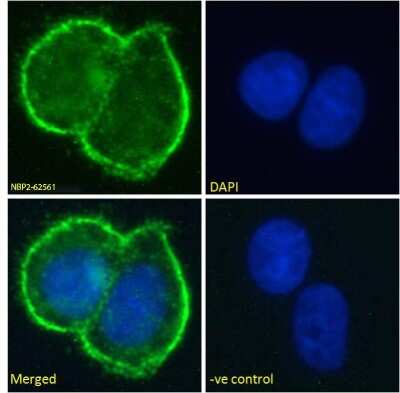 Immunofluorescence: MUC1 Antibody (SM3) - Chimeric - Azide and BSA Free [NBP2-62561]