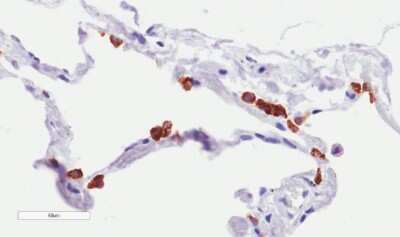 Immunohistochemistry: MUC1 Antibody (SM3) - Chimeric - Azide and BSA Free [NBP2-62561]
