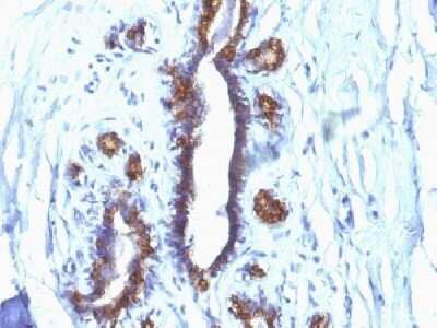 Immunohistochemistry-Paraffin: MUC1 Antibody (SPM132) - Azide and BSA Free [NBP2-34737]