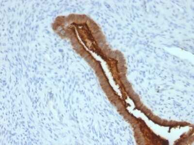 Immunohistochemistry-Paraffin: MUC1 Antibody (SPM492) - Azide and BSA Free [NBP2-47889]