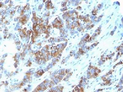 Immunohistochemistry-Paraffin: MUC1 Antibody (SPM533) - Azide and BSA Free [NBP2-34782]