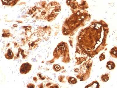 Immunohistochemistry-Paraffin: MUC1 Antibody (rMUC1/960) - Azide and BSA Free [NBP2-54346]