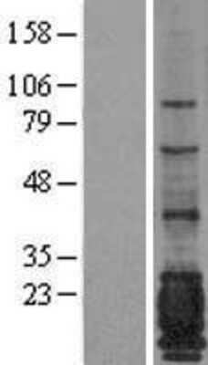 Western Blot: MUC1 Overexpression Lysate [NBL1-13391]