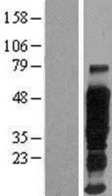 Western Blot: MUC1 Overexpression Lysate [NBP2-08671]