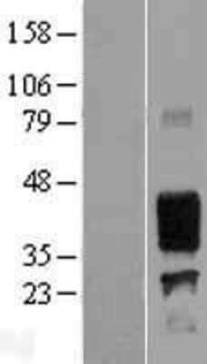 Western Blot: MUC1 Overexpression Lysate [NBP2-08672]