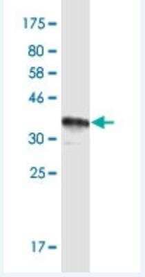 Western Blot: MUC12 Antibody (8B10) [H00010071-M01-100ug]