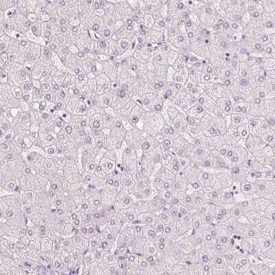 Immunohistochemistry-Paraffin: MUC12 Antibody [NBP1-82607]
