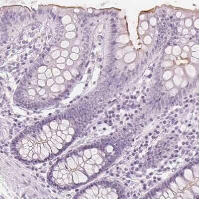 Immunohistochemistry-Paraffin: MUC12 Antibody [NBP1-82607]