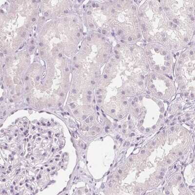 Immunohistochemistry-Paraffin: MUC12 Antibody [NBP1-82607]