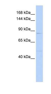 Western Blot: MUC12 Antibody [NBP1-59719]