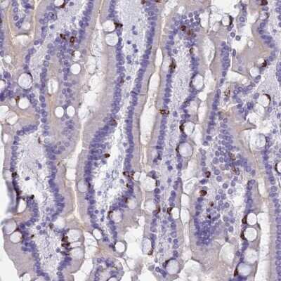 Immunohistochemistry-Paraffin: MUC13 Antibody [NBP1-92147]