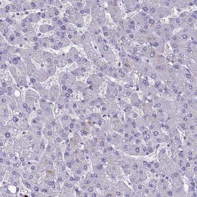 Immunohistochemistry-Paraffin: MUC13 Antibody [NBP1-92147]