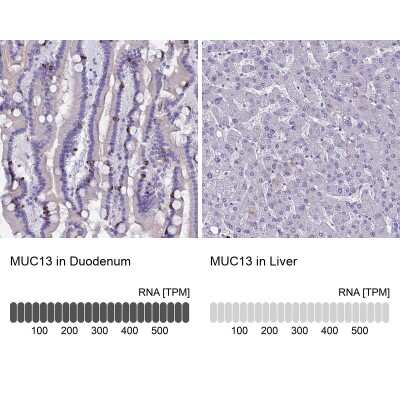 Immunohistochemistry-Paraffin: MUC13 Antibody [NBP1-92147]