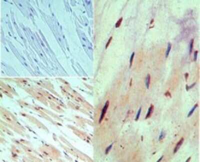 Immunohistochemistry-Paraffin: MUC13 Antibody - BSA Free [NBP2-24566]