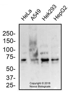 Western Blot: MUC13 AntibodyBSA Free [NBP2-24566]